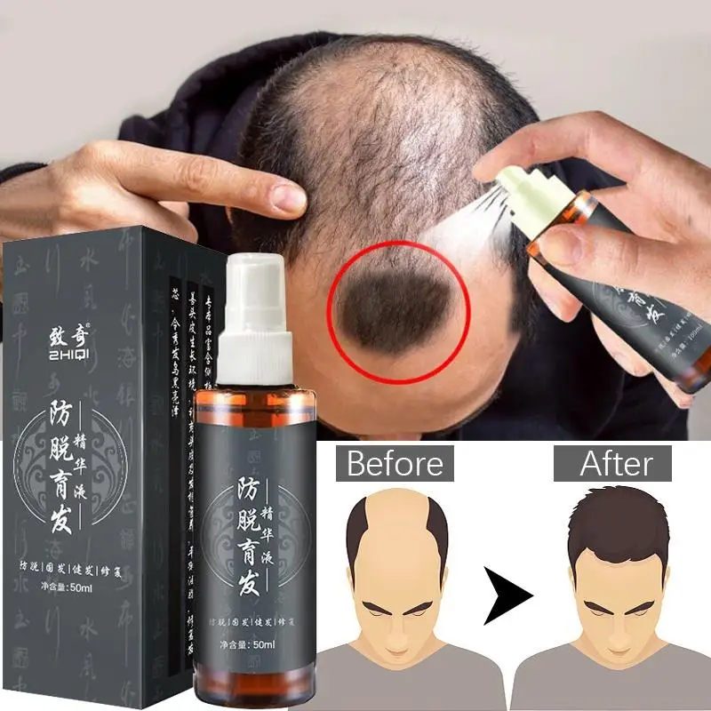 Best of Hair Tonic Serum Fast Growth Serum For Men &Women Head Care Products Anti Hair Loss Serum Reviews & Tips