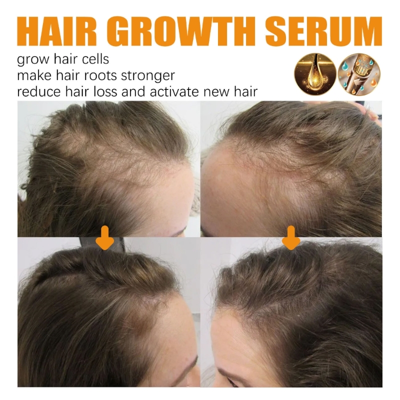 Description Picture 6 of itemHair Growth Serum for Black Women Anti-Loss Nourishing Dry Damaged Hair Repair Fast Natural Hair Growth E0BD