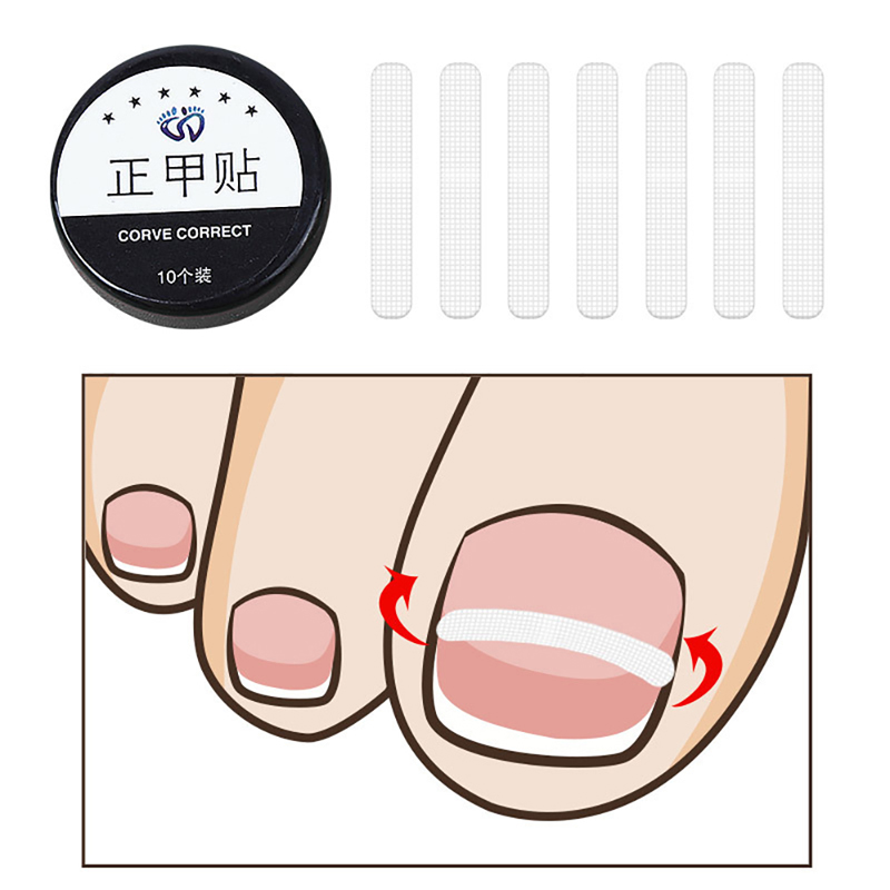 Best of New Ingrown Toe Nail Treatment Ingrown Toenail Correction Tool Elastic Patch Sticker Straightening Clip Brace Pedicure Tools Reviews & Tips