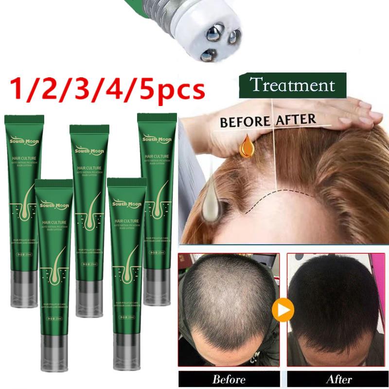 Best of 1 / 2 / 3 / 5PCS Serum Serum For Hair Essence Anti Hair Loss Products Fast Grow Prevent Hair Oil Dry Reviews & Tips