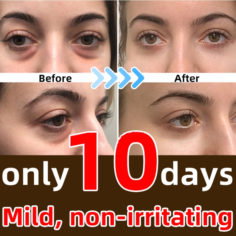 Best of Collagen Anti-Aging Eye Cream Remove Wrinkle Relieves Dark Circle Eye Bags Puffiness Lifting Firming Fine Line Skin Barrier Care Reviews & Tips - Image 2