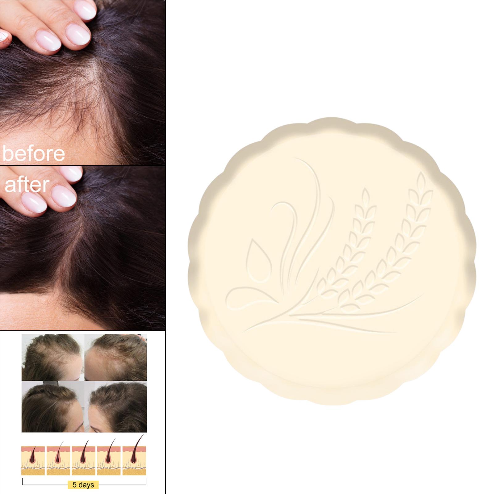 Rice Shampoo Bar Moisturizing Eco Friendly Solid Shampoo Soap for Hair Growth Promotes Healthy Hair Growth Dry Damaged Hair Girl