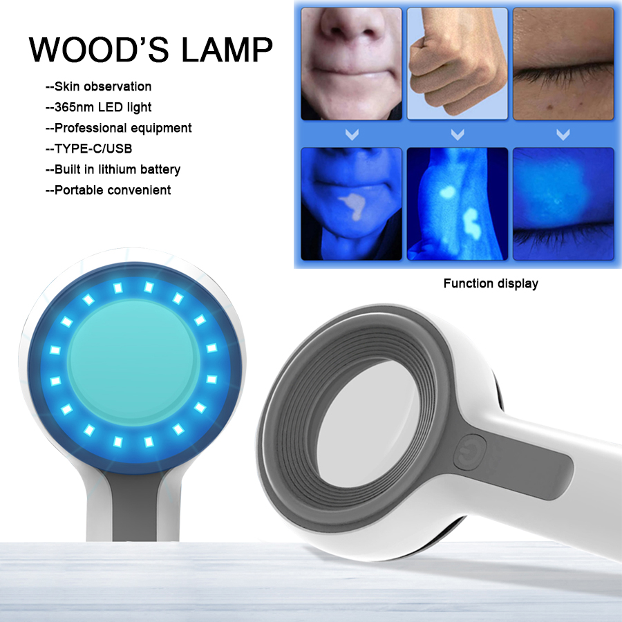 Best of Woods Lamp Skin Analyzer For Skin Uv Magnifying For Personal Care Equipment Facial Beauty Tester Skin Analysis Reviews & Tips