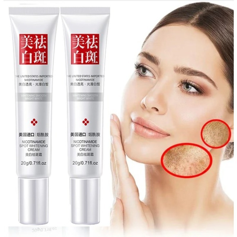 Best of Freckle Whitening Cream Black Dots Melasma Removal Anti Brown Stain Lighten Pigmentation Moisturizing Skin Care Korean Products Reviews & Tips