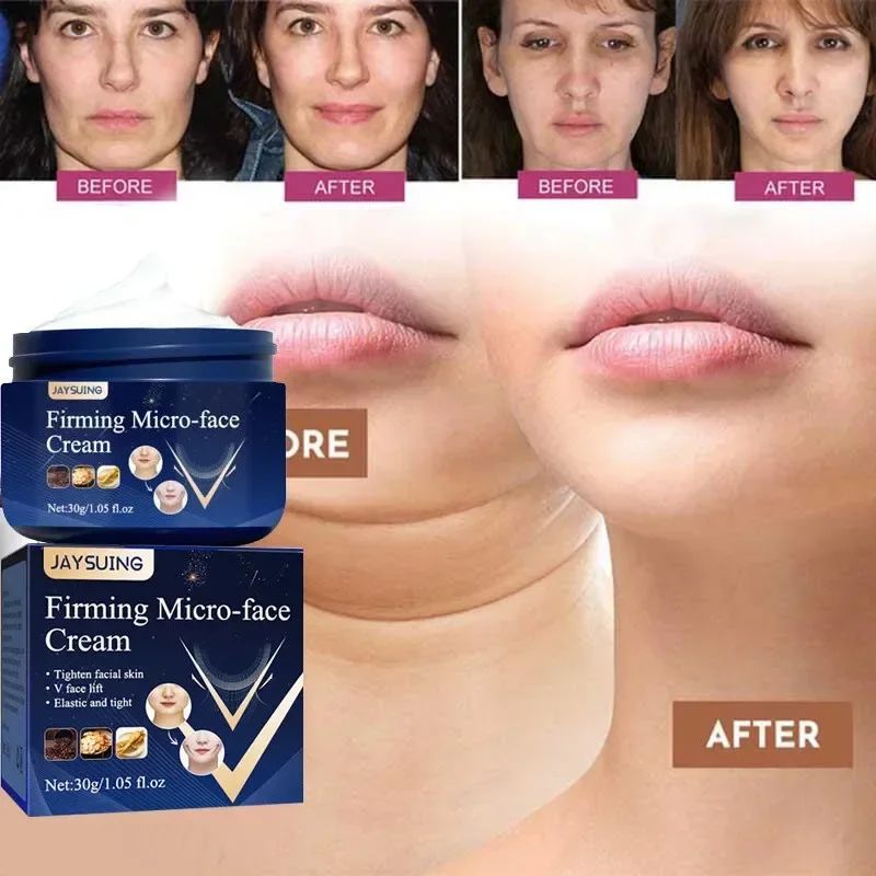 Best of Face-lift Slimming Cream Thin V Face Lift Firming Removal Masseter Muscle Double Chin Anti-aging Moisturizing Beauty Skin Care Reviews & Tips