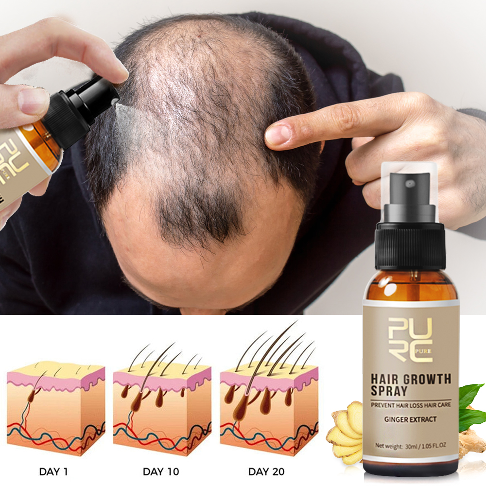 Best of PURC Hair Growth Products For Men Women Hair Loss Treatment Oil Ginger Fast Hair Regrowth Spray Thinning Hair Care Products Reviews & Tips