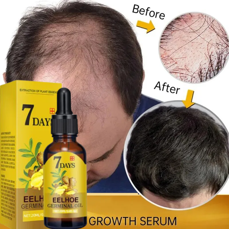 Best of Fast Hair Growth Serum Ginger Natural Anti Hair Loss Regrowth Essential Oil For Men Baldhead Repair Women Damaged Hair Root Care Reviews & Tips