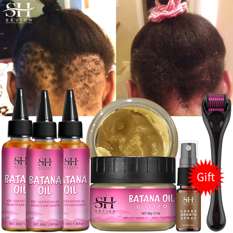 Best of Buy 3 Get 2 African Batana Oil Hair Growth 100% Pure Batana Butter Hair Mask Baldness Hereditary Hair Regrowth Treatment Serum Reviews & Tips