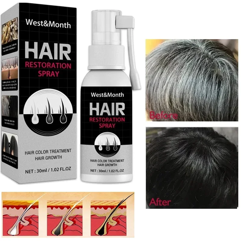 Best of Black Hair Growth Spray Prevent Elderly White Hair Restore Herbal Oil Anti-Hair Loss Treatment Repair Dry Damaged Essential Care Reviews & Tips