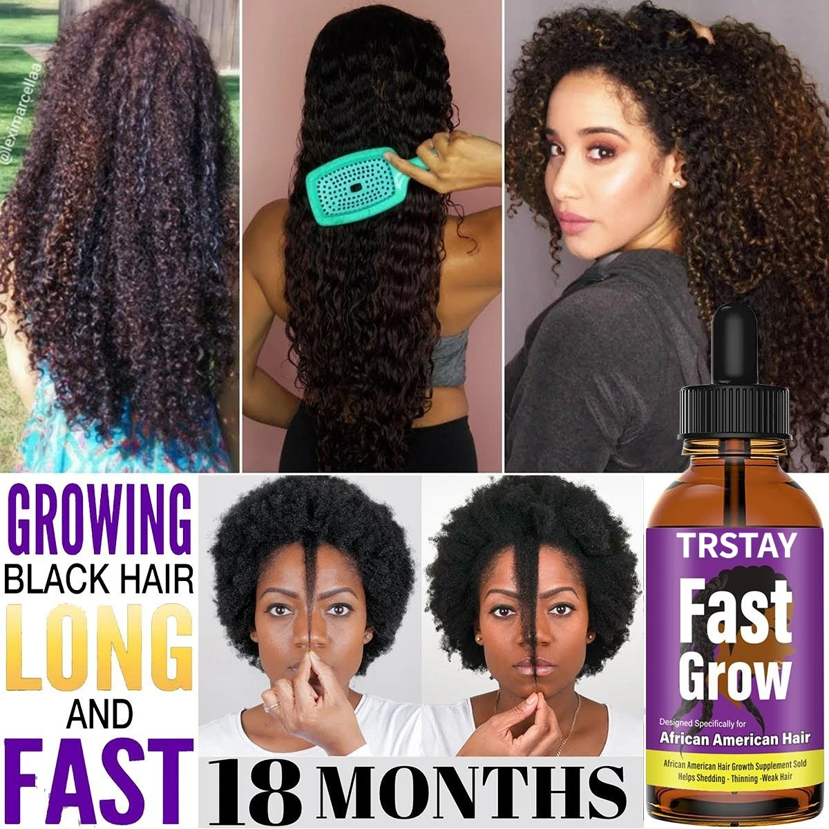Anti Alopecia Oil Hair Growth Essential Oils For Black Women Essence Anti-hair  Loss Hair Serum For Thinning Hair Thickening - Hair Loss Product Series -  AliExpress