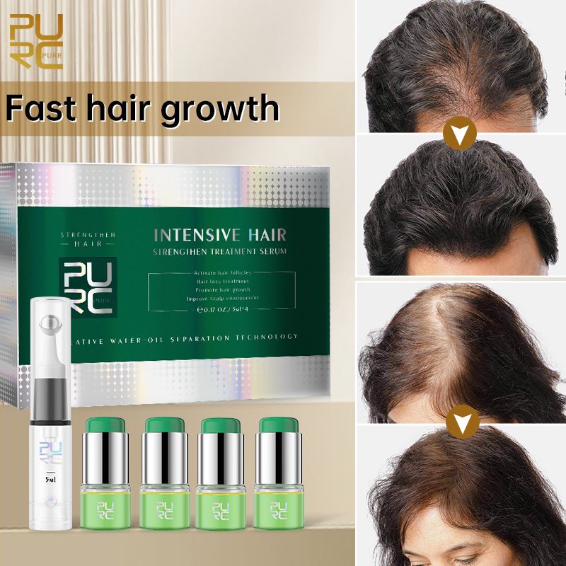 Best of PURC Rosemary Oil Hair Growth Products For Men Women Ginger Ginseng Regrowth Oil Anti Hair Loss Scalp Treatment Hair Care Reviews & Tips