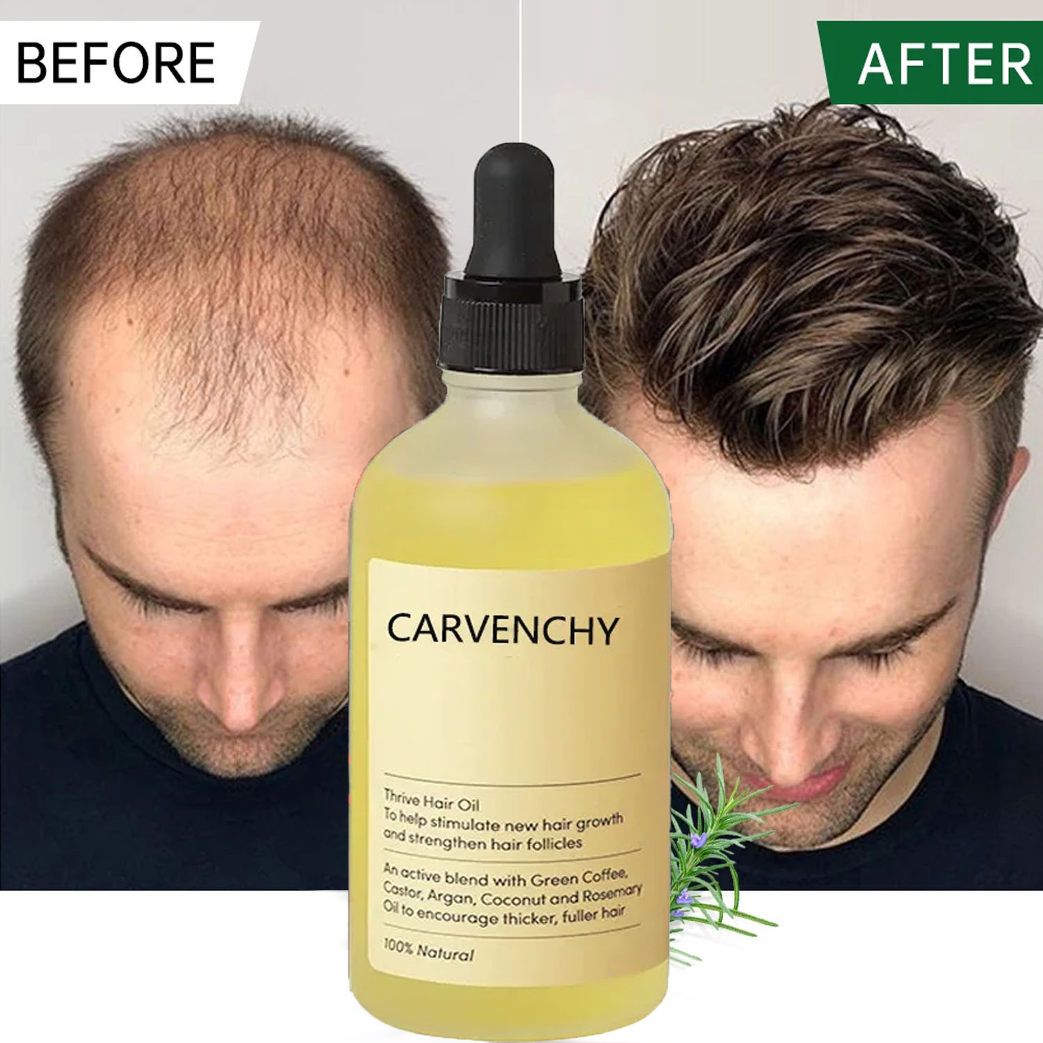 Best of Hair Growth Products Fast Growing Prevent Hair Loss Essential Oil Anti-Drying Scalp Treatment Repair Beauty Health For Men Women Reviews & Tips