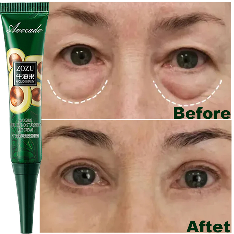 Best of Instant Remove Wrinkles Eye Cream Anti Dark Circles Bags Puffiness Fade Eye Fine Line Tighten Whiten Under Eyes Skin Korean Care Reviews & Tips