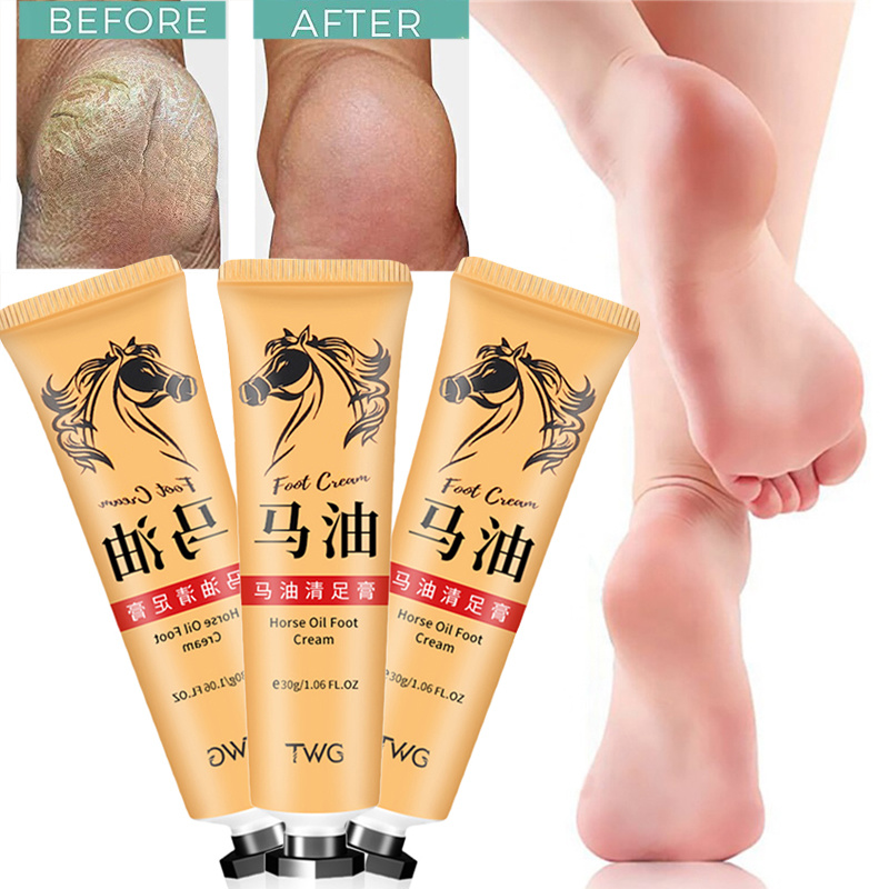 Best of Horse Oil Anti Crack Foot Cream Heel Cracked Repair Cream Smooth Removal Dead Skin Callus Anti-Drying Hand Feet Skin Care 30g Reviews & Tips