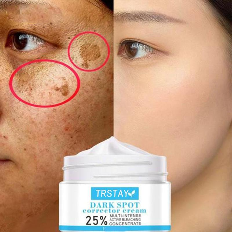 Best of Natural Extract Lighten Melanin Essence Face Cream Remove Dark Spot Age Spots Lifting Firm Facial Skin Cream Reviews & Tips