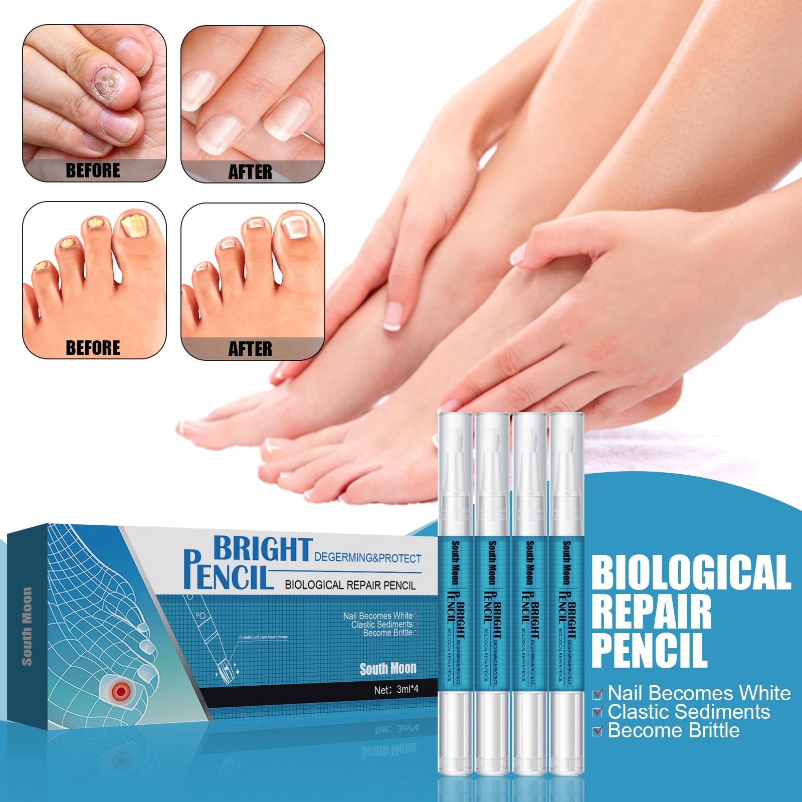 4Pcs Nail Repair Liquid Pen 3ml Discoloration Foot Nail Promote Healthy Growth Remover Gentle Anti Fungal for Nail Fungus Toes