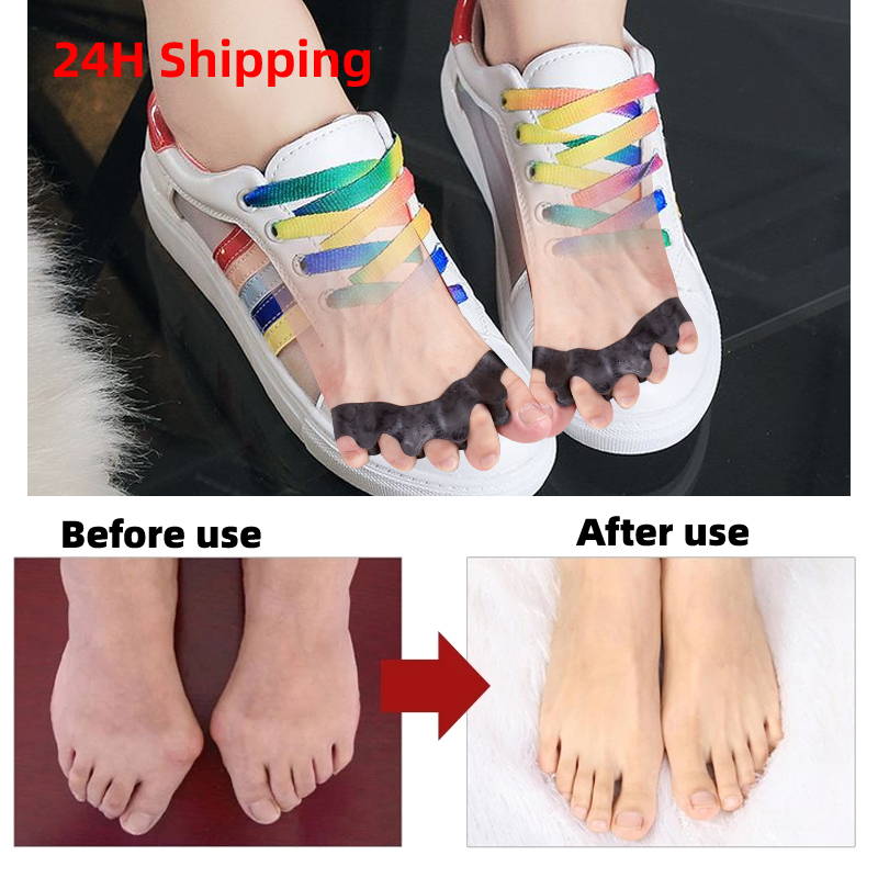 Best of 2Pcs=1Pair Black Orthopedic Product Silicone Separator Gel Toe Protector Bunion Corrector Foot Finger Straightener Pedicure Tool Reviews & Tips - Image 2