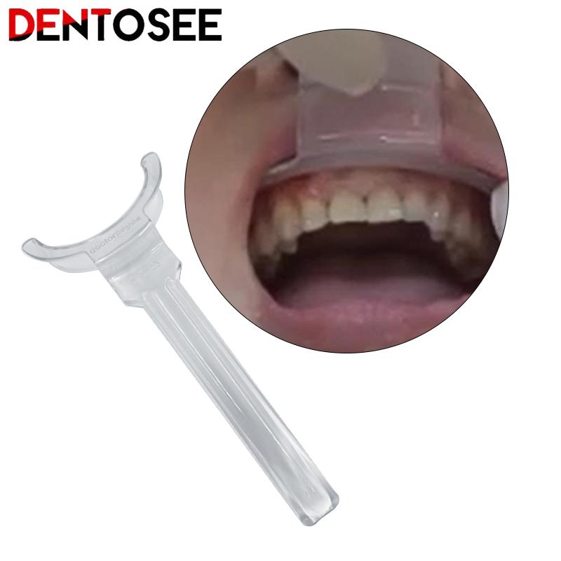 Best of Dental Lip Retractor Double-Head Lip Retractor Intraoral Cheek Mouth Opener Orthodontic Dental Tools Reviews & Tips