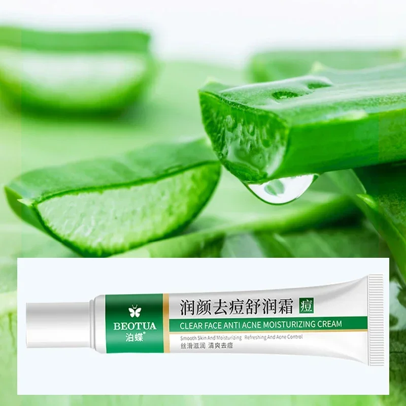 Best of Effective Acne Removal Cream Aloe Acne Spots Oil Control Anti-aging Moisturizing Whitening Acne Cream Treatment Skin Care 20g Reviews & Tips - Image 5