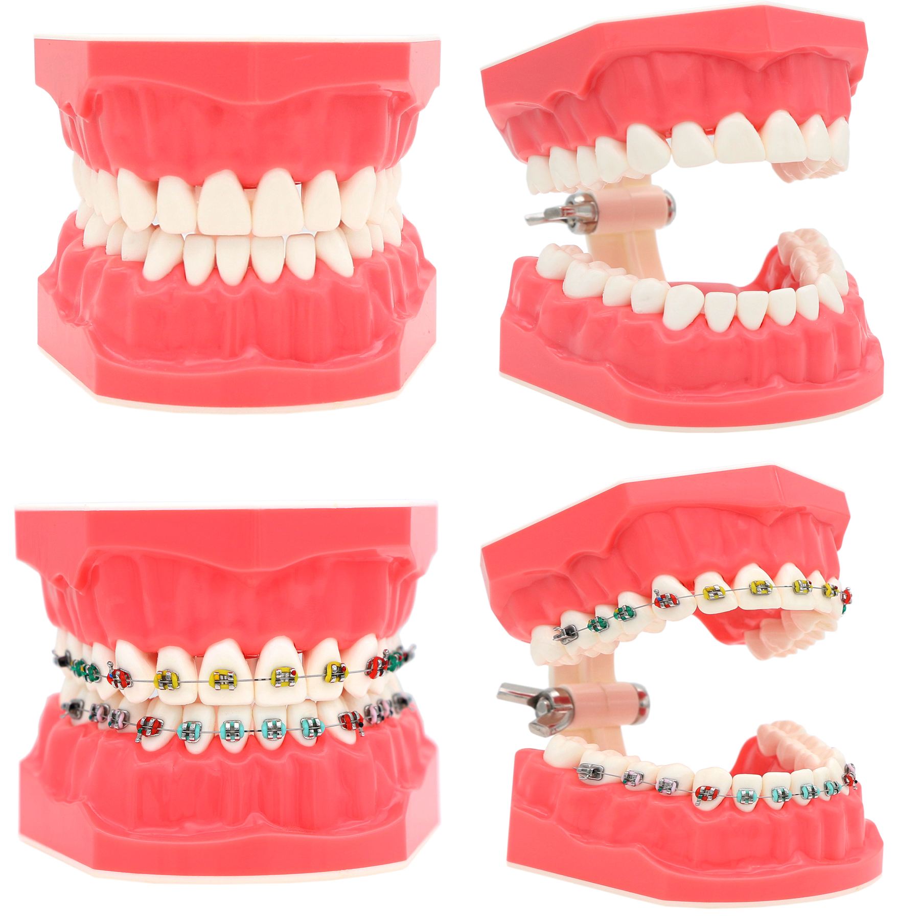 Best of Dental Teaching Model Dentistry Orthodontic Teeth Model With Brackets For Dentist Studying Patient Demo Reviews & Tips