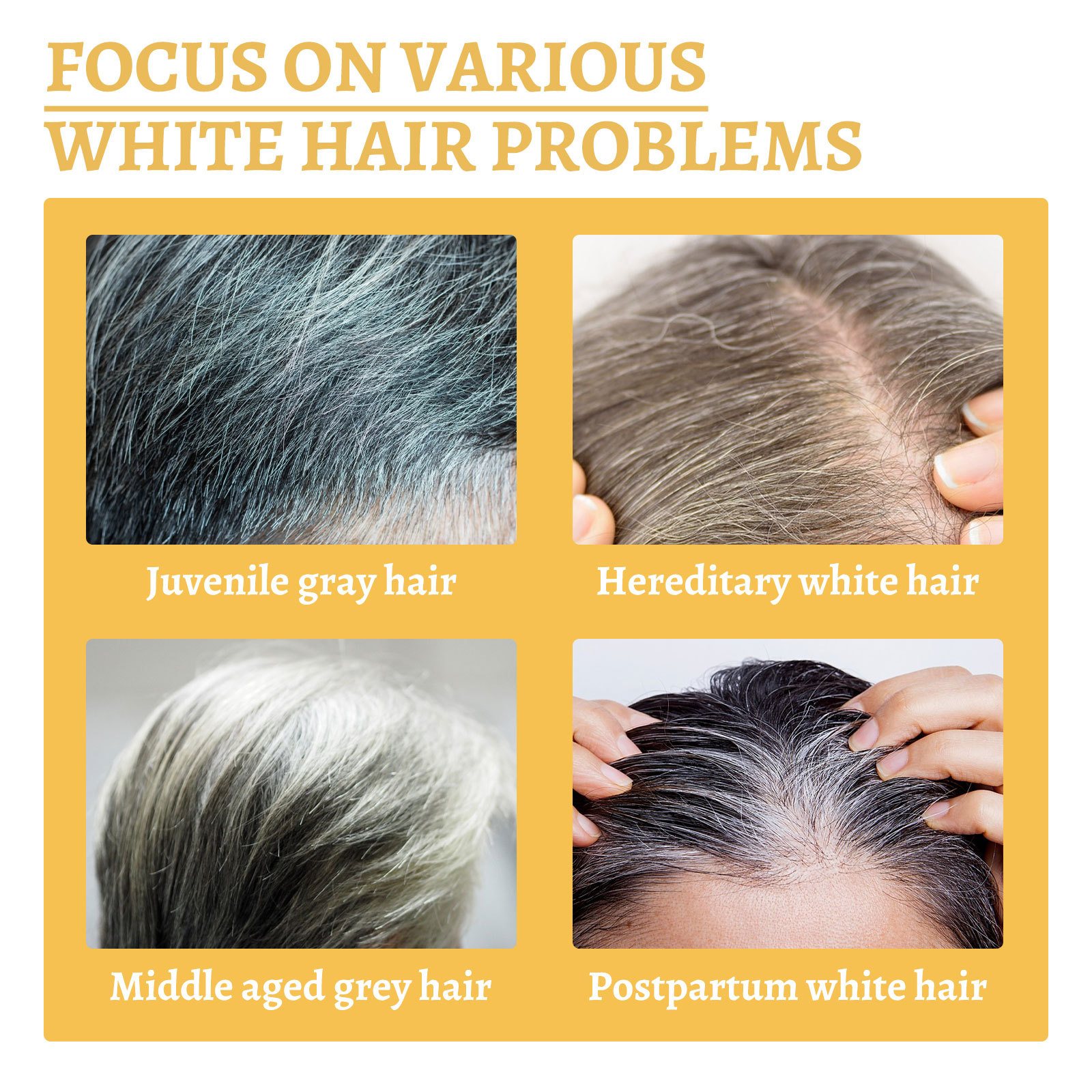 Best of 10PCS Gray White Hair Treatment Serum Liquid White To Black Natural Color Repair Products Anti Loss Hair Nourish Care Men Women Reviews & Tips - Image 4