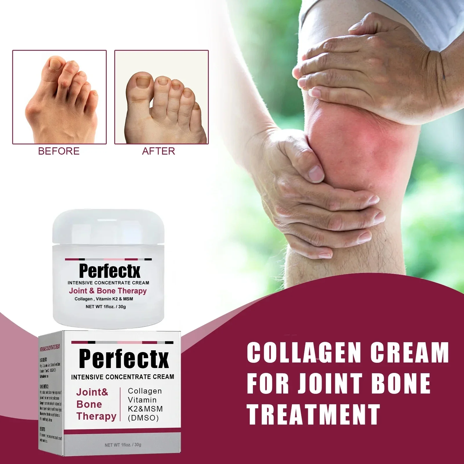 Best of Perfectx Collagen Tenosynovitis Treatment Ointment No Box Treatment Of Back Muscle Pain Joint Strain Neck Plaster Relief Cream Reviews & Tips