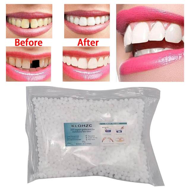  Temporary Teeth Repair Kit,Tooth Repair Kit For Missing  Teeth, Cavity Filler For Teeth,Temp Tooth Beads