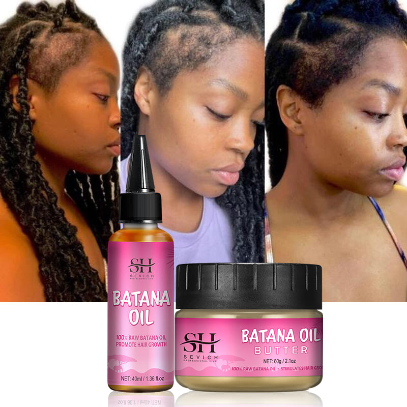 Best of 2023 Batana Hair Growth Oil For Black Women 100% Natural Batana Butter For Hair Loss Treatment For Black Men &amp; Women Hair Care Reviews & Tips