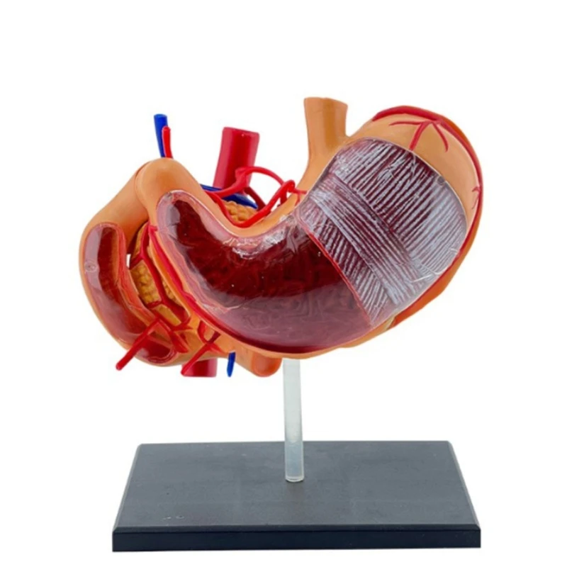 J6PA Profissionais PVC Anatomia do Estômago Modelo