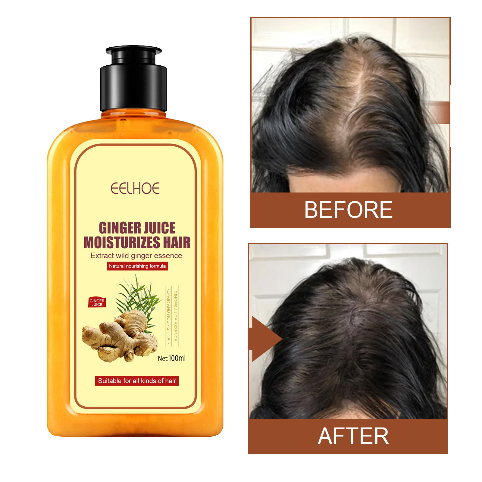 Best of Ginger Hair Regrowth Shampoo Hair Loss Improve Dry Forked Hair Cleansing Dandruff Scalp Growth Anti-Hair Loss Hair Shampoo Reviews & Tips