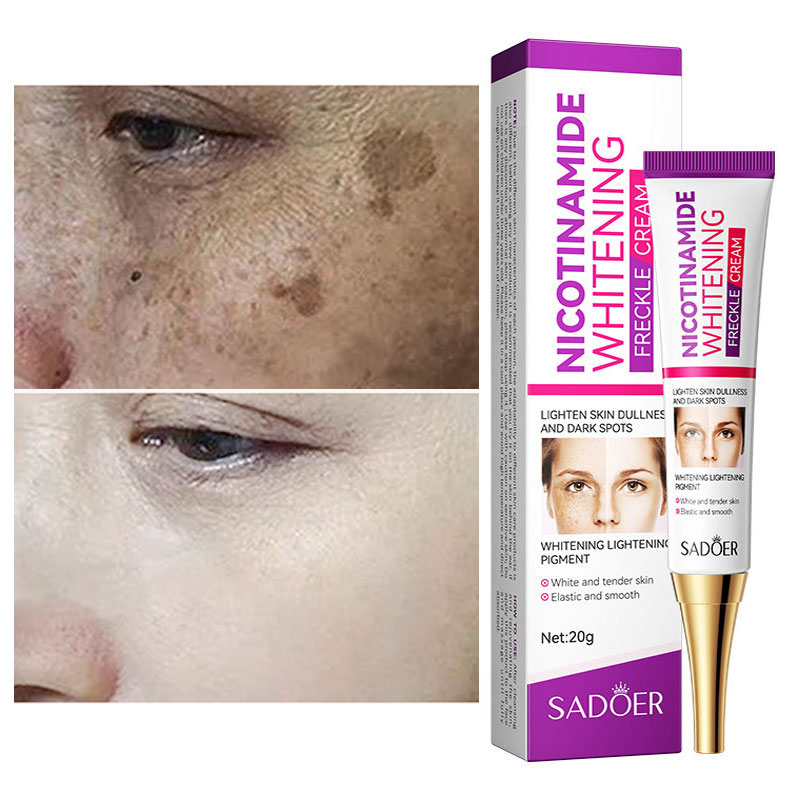 Best of Nicotinamide Whitening Freckles Cream Remove Melasma Dark Spot Acne Marks Lightening Melanin Brightens Skin Tone Face Skin Care Reviews & Tips