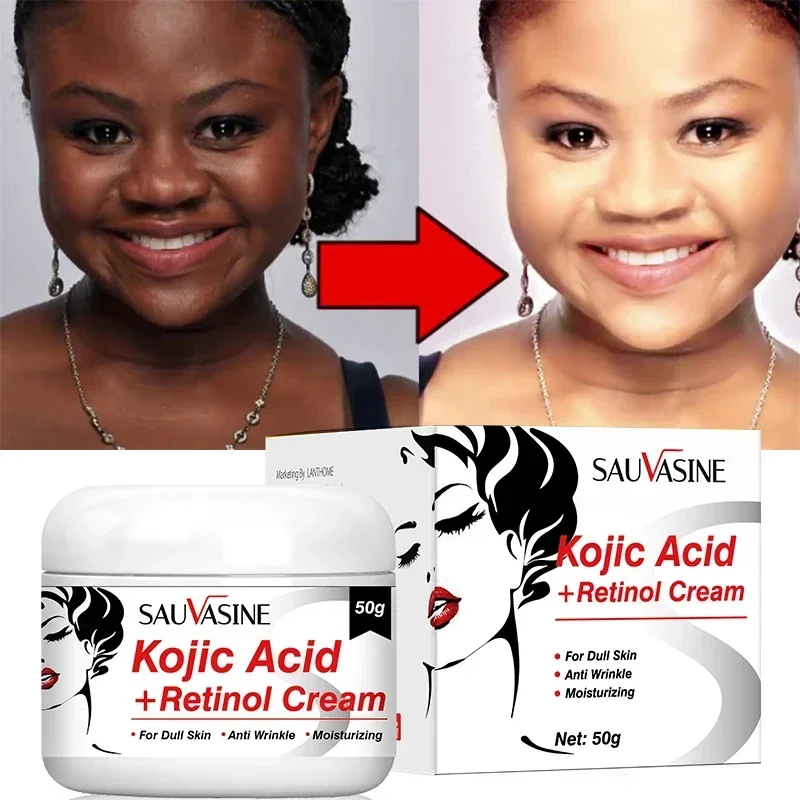 Best of Kojic Acid Cream Remove Pigment Melanin Whitening Remove Dark Spots Cream Nourishing &amp; Resurfacing Fade Skin Care Face Cream Reviews & Tips