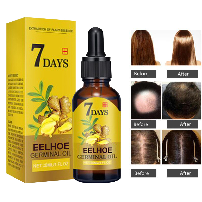 Best of Ginger Hair Growth Products Fast Growing Hair Essential Oil Natural Anti Hair Loss Prevent Hair Dry Frizzy Damaged Repair Care Reviews & Tips - Image 3