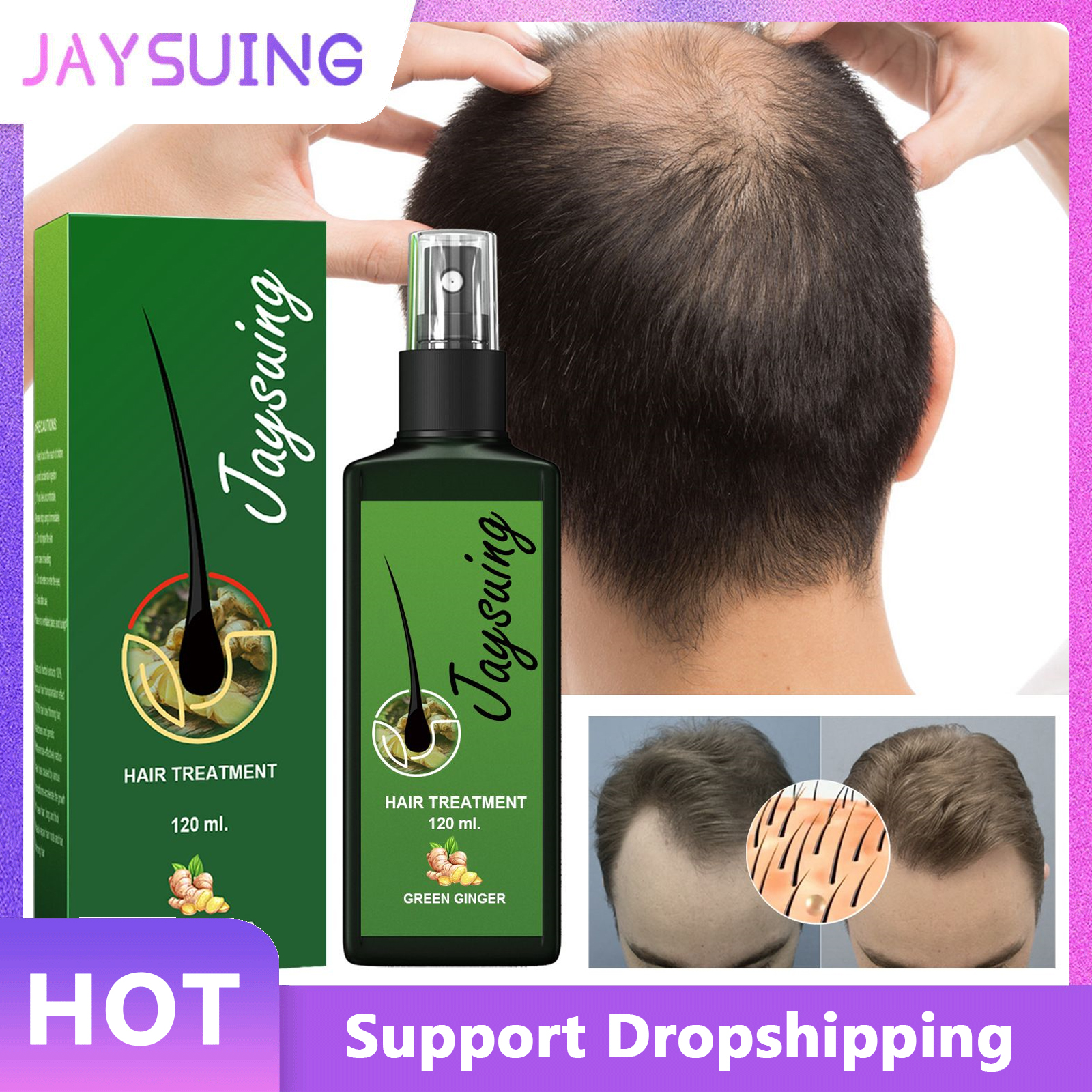 Best of Hair Growth Spray Effective Nourishing Root Hair Thick Growth Liquid Anti Hair Loss Ginger Anti-fall Scalp Massage Repair Spray Reviews & Tips