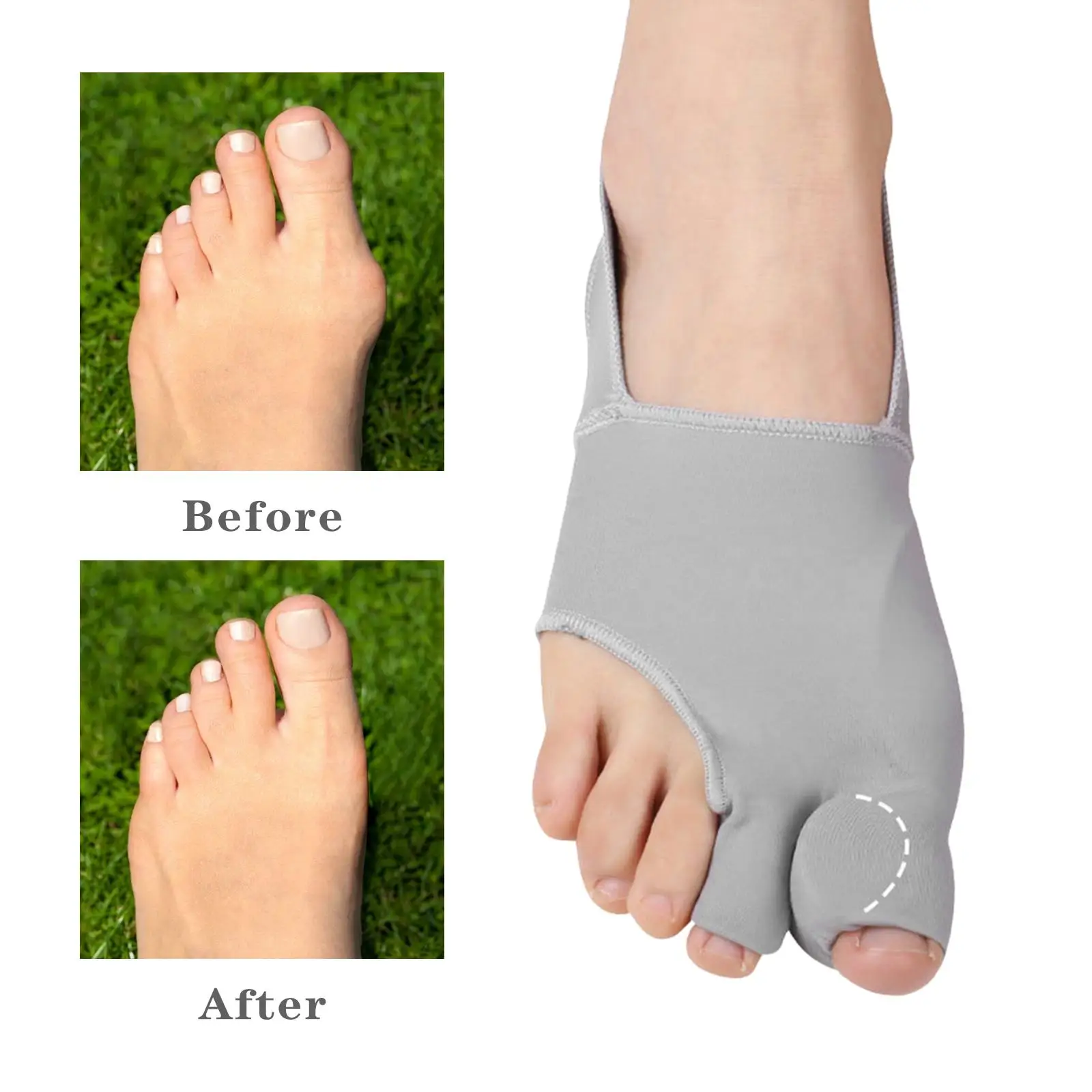 Big Toe Splint Straightener Right Feet Cloth Comfortable External Durable Thumb Protector Corrector for Hallux Valgus Correction