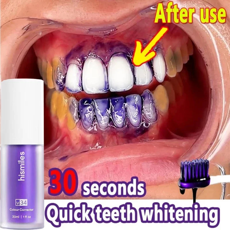 Best of V34 Teeth Whitening Toothpaste Serum Remove Plaque Stains Oral Hygiene Cleaning Dental Bleaching Tools Fresh Breath Tooth Care Reviews & Tips