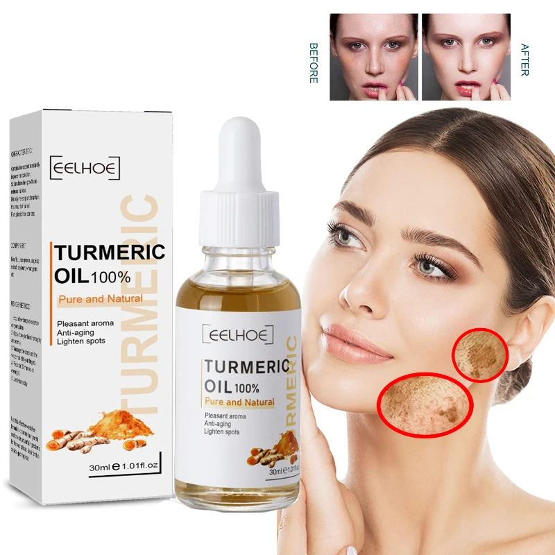 Best of Freckle Remove Turmeric Serum Curcumin Oil Face Whitening Brighten Moisturizing Fade Dark Spot Removal Melaninskin Turmeric Oil Reviews & Tips