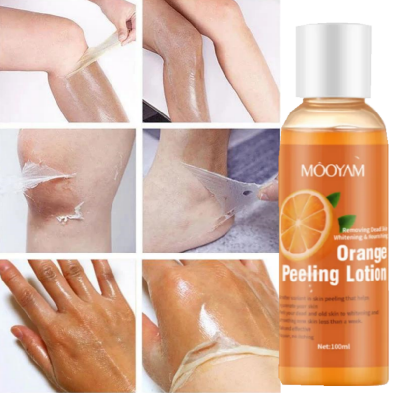 Best of Body Whitening Yellow Peeling Oil Dark Skin Bleach Remove Arm Knee Legs Melanin Body Brighten Scrub Foot Exfoliating Dead Skin Reviews & Tips