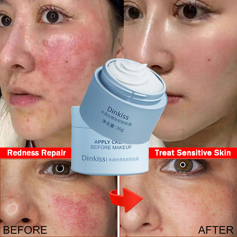 Best of Effective Facial Redness Repair Cream Rosacea Treat Sensitive Skin Dryness Moisturizer Hydrating Sooth Lotion Korean Cosmetics Reviews & Tips