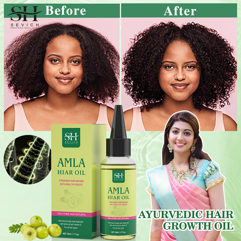 Best of Original Amla Oil For Hair Growth India Gooseberry Hair Oil Anti Hair Loss Scalp Treatment Ayurvedic Hair Growth Oil Sevich Reviews & Tips