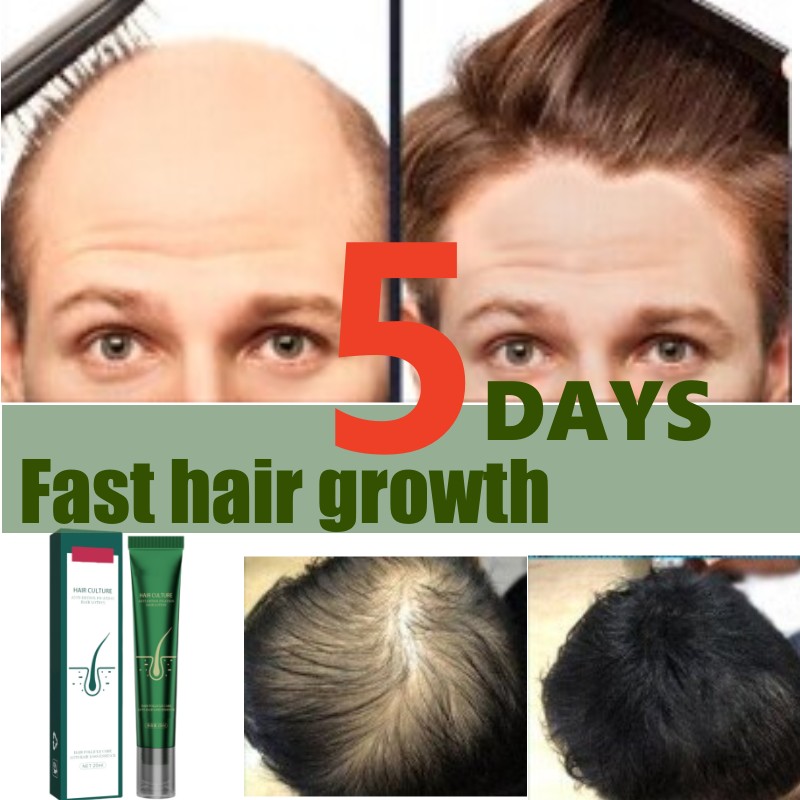 Best of Hair Growth Oil For Men Biotin Fast Treatment Baldness Serum Hair Growth Essence Strengthens Repair Ginger Scalp Hair Care Reviews & Tips