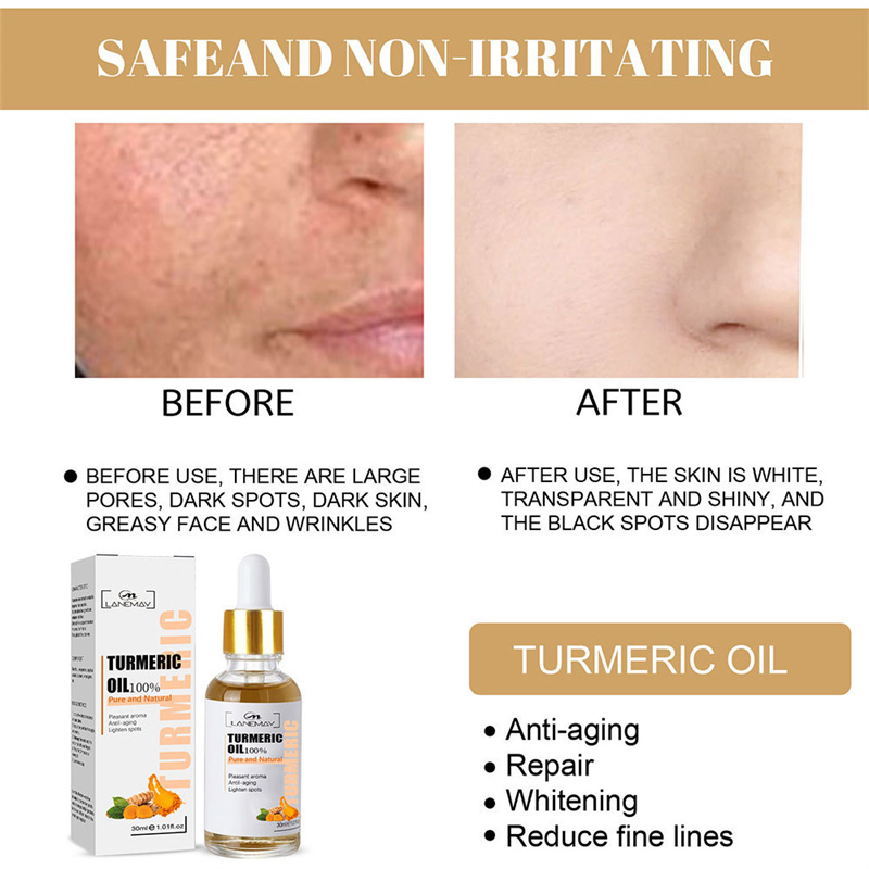 Best of Turmeric Freckle Whitening Serum Fade Dark Spots Removal Pigment Melanin Correcting Facial Beauty Face Skin Care Products 30ml Reviews & Tips - Image 4