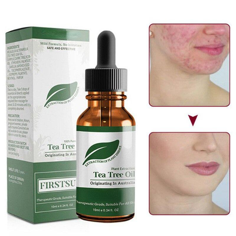 Best of Natural Tea Tree Oil Moisturizer Face Body Skin Hair Care Women Fragrance Aromatherapy Pure Massage Serum Oil Beauty Healt Reviews & Tips