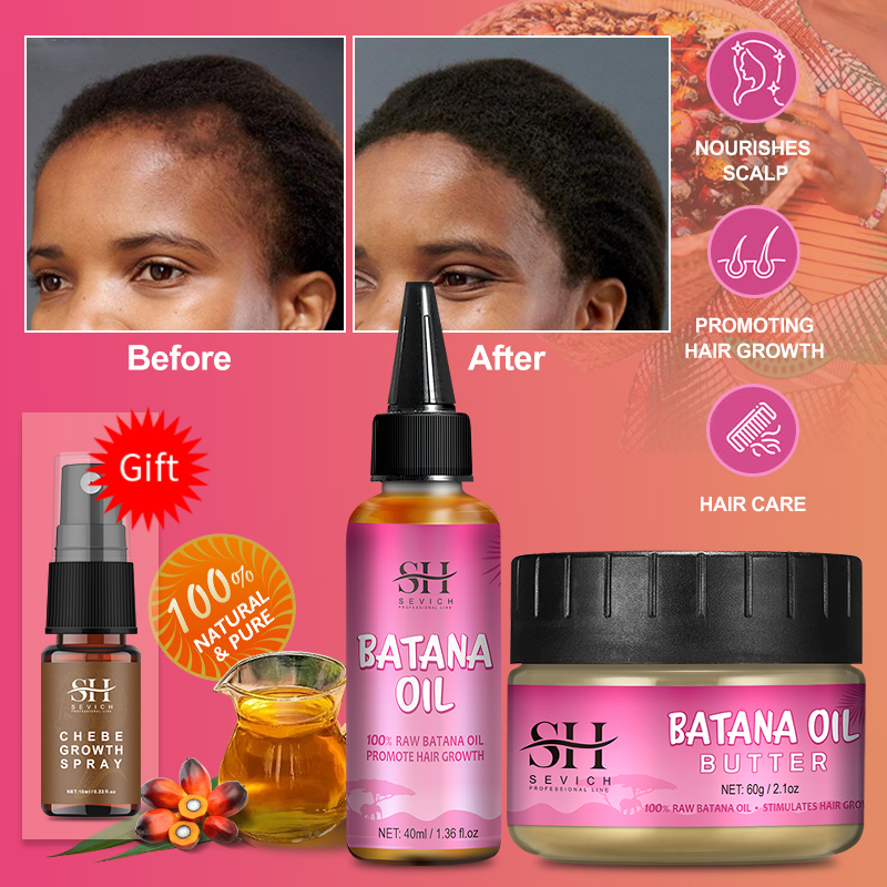 Best of 100% Pure Batana Growth Oil Set For Traction Alopecia Butter Hair Mask Anti Break Loss Hair Growth Oil For Black Men &amp; Women Reviews & Tips