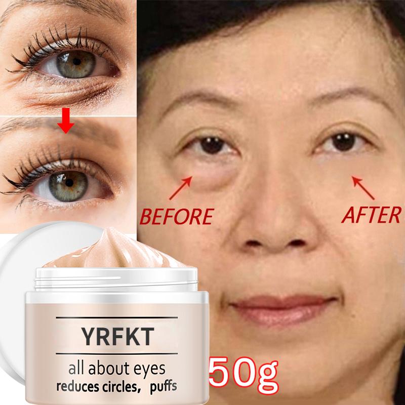 Best of Peptide Anti Wrinkle Black Eye Cream, Serum Gel, Compact Whitening Edema, Eye Care Dark Circle Remover Eye Cream Reviews & Tips