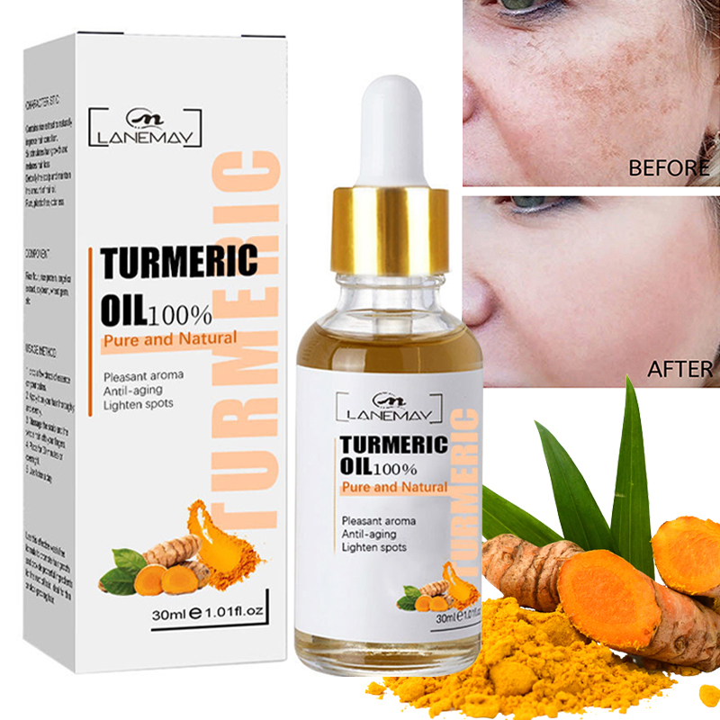 Best of Turmeric Freckle Whitening Serum Fade Dark Spots Removal Pigment Melanin Correcting Facial Beauty Face Skin Care Products 30ml Reviews & Tips