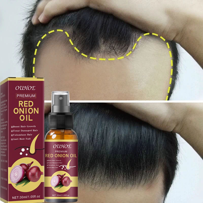 Best of Powerful Hair Growth Serum Spray Anti Hairs Loss Treatment Essence Repair Nourish Roots Regrowth Hair Care Product For Men Women Reviews & Tips