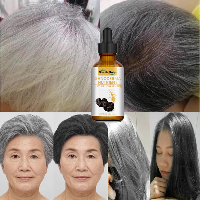 Best of 10PCS Gray White Hair Treatment Serum Liquid White To Black Natural Color Repair Products Anti Loss Hair Nourish Care Men Women Reviews & Tips - Image 2