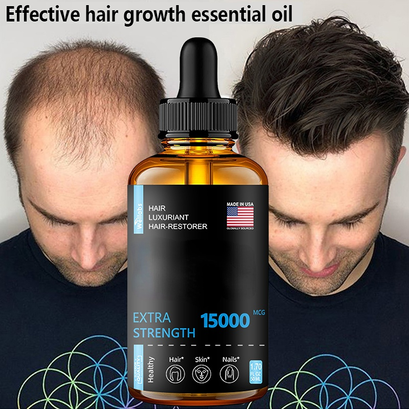 Best of Hair Growth Essential Oils Products Ginger Essence Fast Regrowth Serum Beard Growth Oil Hair Loss Care Beauty Scalp Treatment Reviews & Tips