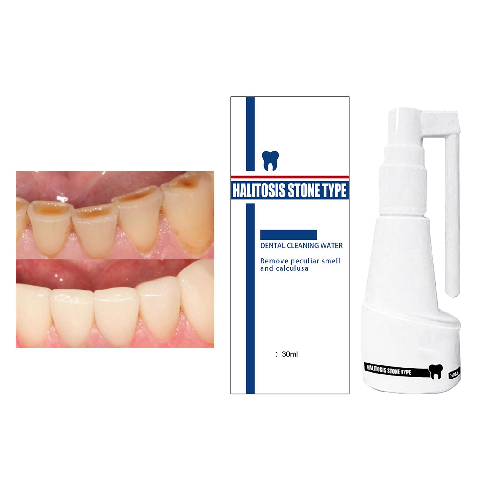Mouth Clean Spray Antibacteria Stains Remover Tonsil Stones Fresh Breath Oral Care Mouth Freshener Bad Breath for Women Home Use